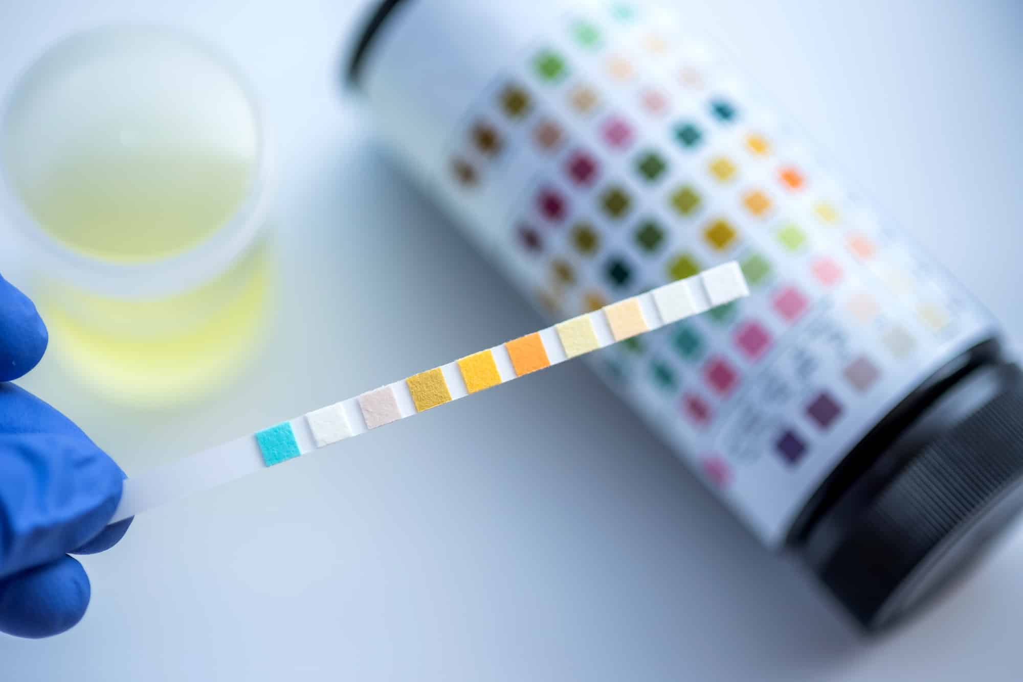 Should You Use In-House or External Alcohol and Drug Testing?