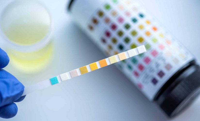 Should You Use In-House or External Alcohol and Drug Testing?